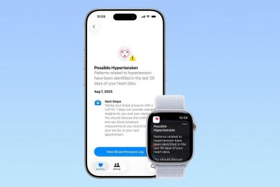 Apple Watch hipertansiyon bildirim özelliği Türkiye'de erişime açıldı