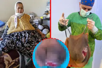 Gün geçtikçe büyüdü! Doktorlar bile gözlerine inanamadı: Karnından tam 40 kilo çıktı!
