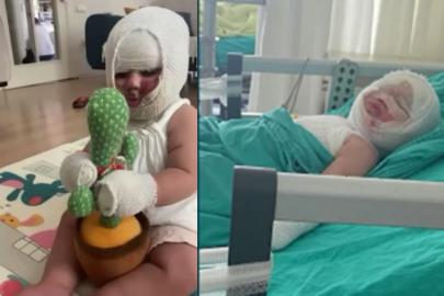 Domates konservesi bomba gibi patladı, 9 aylık bebeğin vücudu yandı