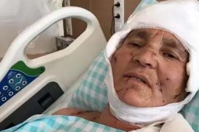 Köpek saldırısında emsal karar! Yargıtay 637 bin liralık tazminatı onadı