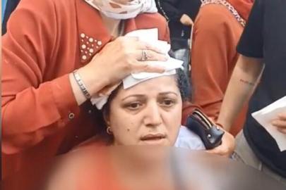 Pazarcı dehşet saçtı: Kadının başına 10 dikiş atıldı