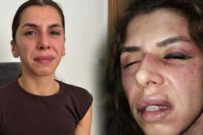 Eşi tarafından 4 saat işkence gördü, boğazına bıçak dayandı: Öldüm sandım ama bayılmışım
