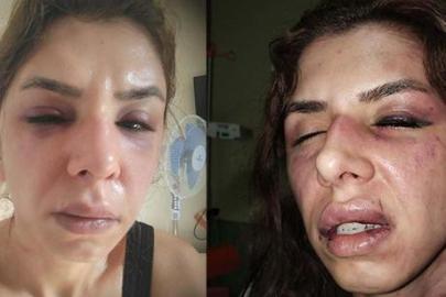 İstanbul’da dehşet! Eşini saatlerce darbedip bıçakla tehdit ettiği iddiası: 'Şehadet getir'