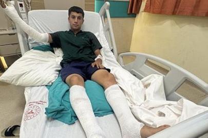 'Kimse evinde bulundurmasın' diye uyardı: Vücudum alev aldı