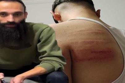 2 çırağı demir sopayla dövdüğü iddia edilmişti! Berber yeniden gözaltında